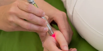 Laserakupunktur